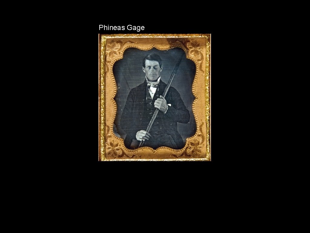 Phineas Gage 