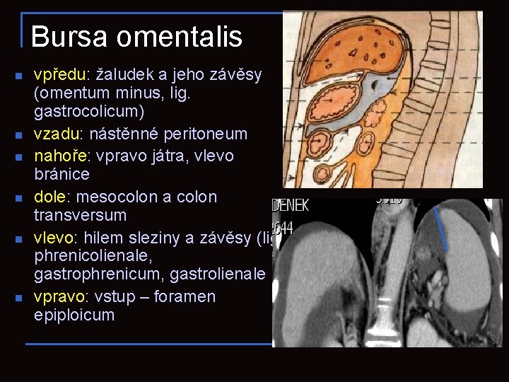 Bursa omentalis n n n vpředu: žaludek a jeho závěsy (omentum minus, lig. gastrocolicum)