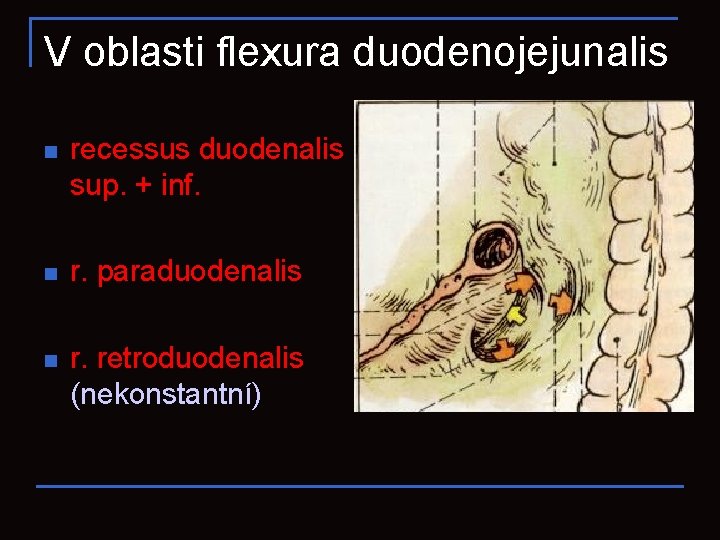 V oblasti flexura duodenojejunalis n recessus duodenalis sup. + inf. n r. paraduodenalis n