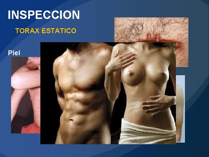 INSPECCION TORAX ESTATICO Piel 