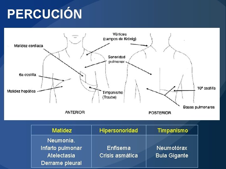 PERCUCIÓN Matidez Hipersonoridad Timpanismo Neumonía. Infarto pulmonar Atelectasia Derrame pleural Enfisema Crisis asmática Neumotórax