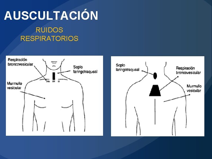 AUSCULTACIÓN RUIDOS RESPIRATORIOS 