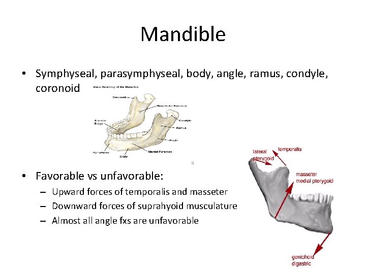 Mandible • Symphyseal, parasymphyseal, body, angle, ramus, condyle, coronoid • Favorable vs unfavorable: –