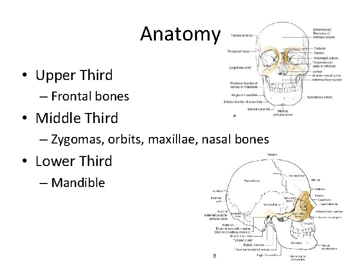 Anatomy • Upper Third – Frontal bones • Middle Third – Zygomas, orbits, maxillae,