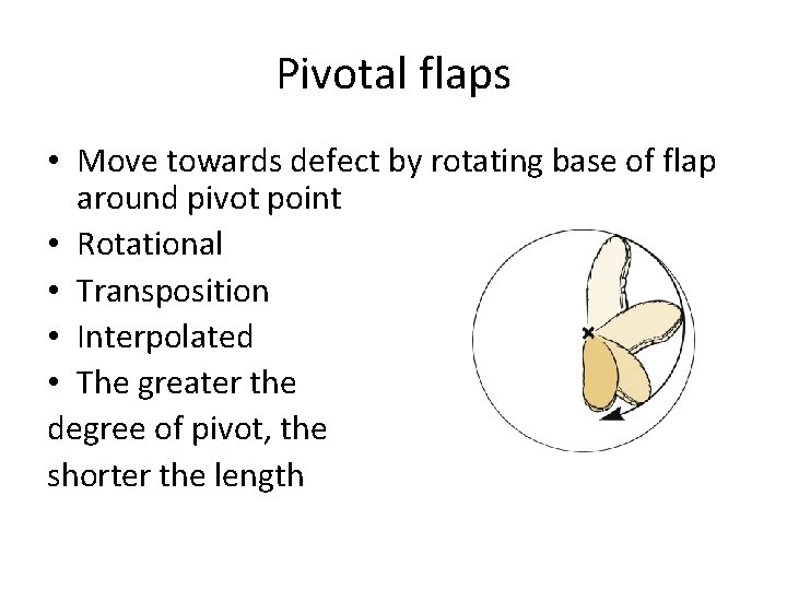 Pivotal flaps • Move towards defect by rotating base of flap around pivot point