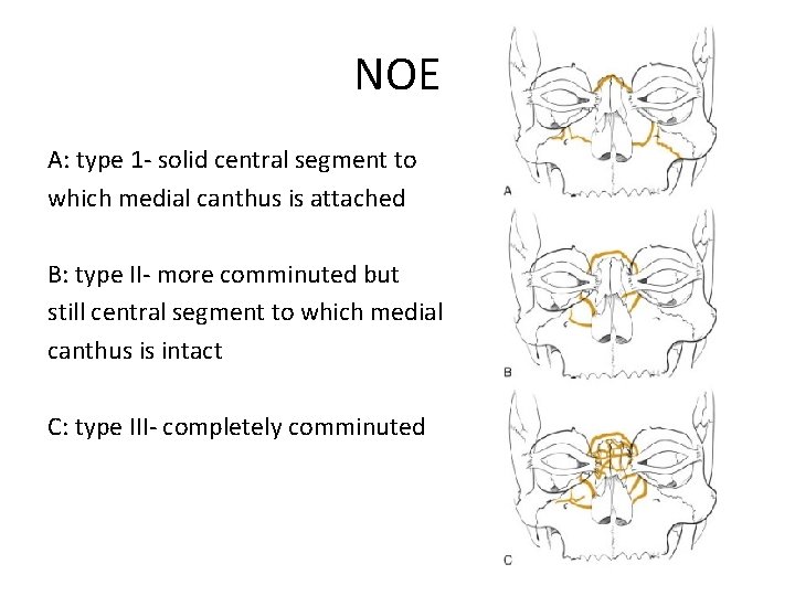 NOE A: type 1 - solid central segment to which medial canthus is attached