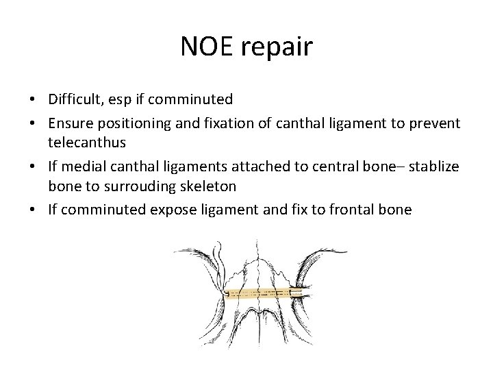 NOE repair • Difficult, esp if comminuted • Ensure positioning and fixation of canthal