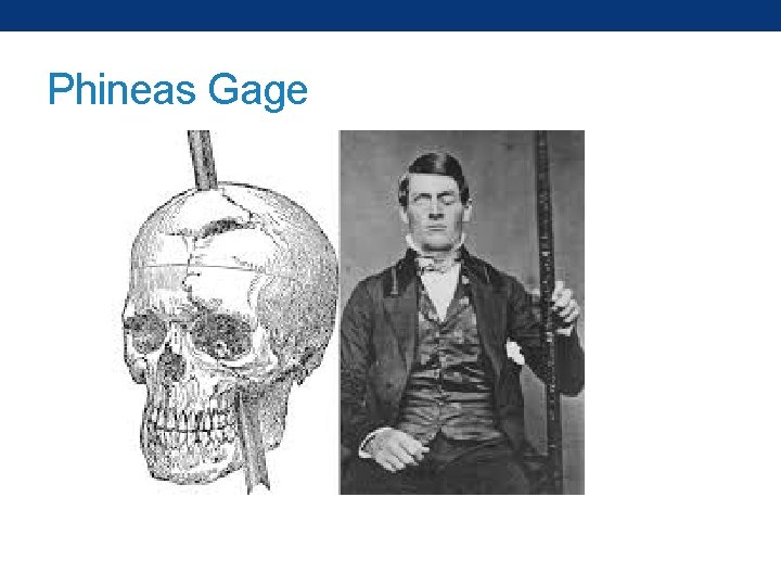 Phineas Gage 
