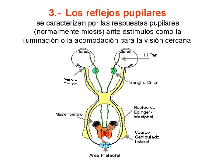 3. - Los reflejos pupilares se caracterizan por las respuestas pupilares (normalmente miosis) ante