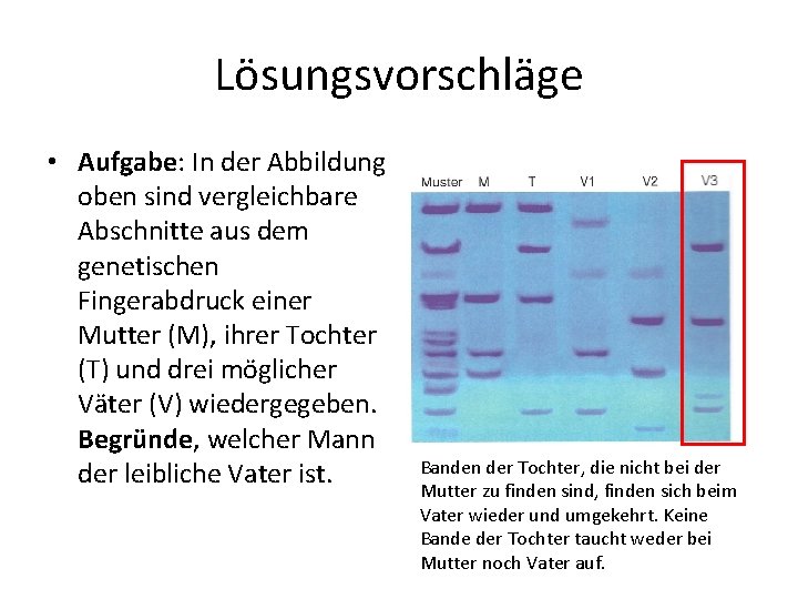 Lösungsvorschläge • Aufgabe: In der Abbildung oben sind vergleichbare Abschnitte aus dem genetischen Fingerabdruck Lösungsvorschläge • Aufgabe: In der Abbildung oben sind vergleichbare Abschnitte aus dem genetischen Fingerabdruck