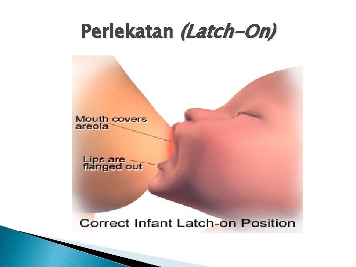 Perlekatan (Latch-On) 