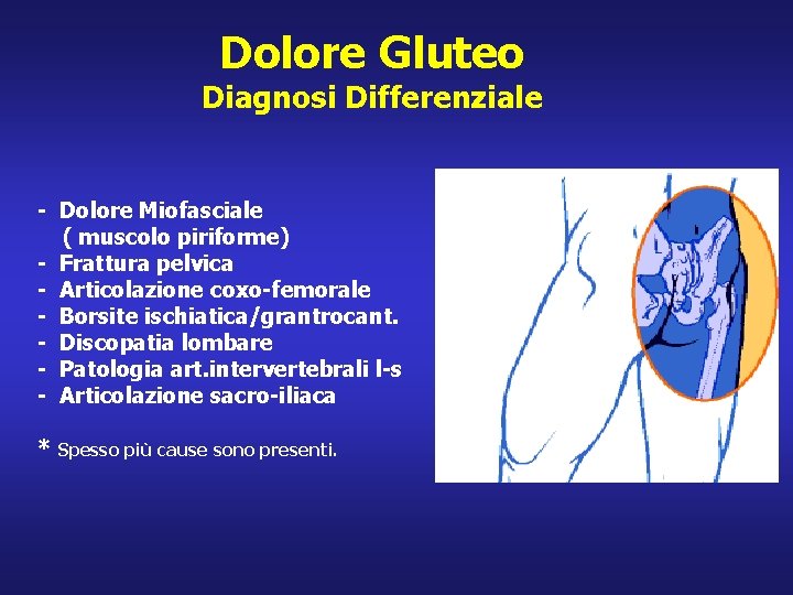 Dolore Gluteo Diagnosi Differenziale - Dolore Miofasciale ( muscolo piriforme) - Frattura pelvica -
