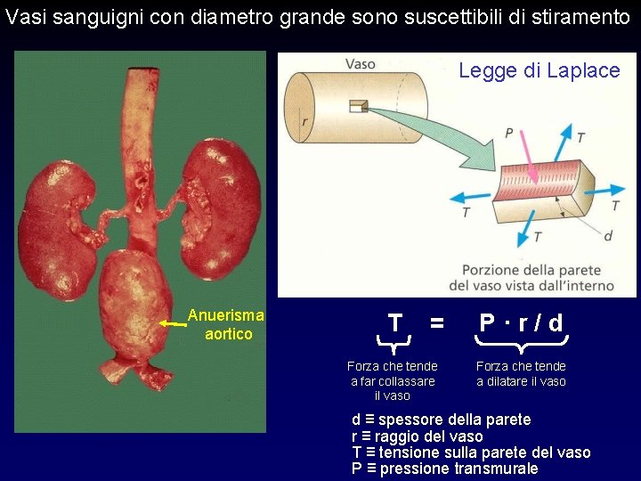 Vasi sanguigni con diametro grande sono suscettibili di stiramento Legge di Laplace Aorta Rene Vasi sanguigni con diametro grande sono suscettibili di stiramento Legge di Laplace Aorta Rene