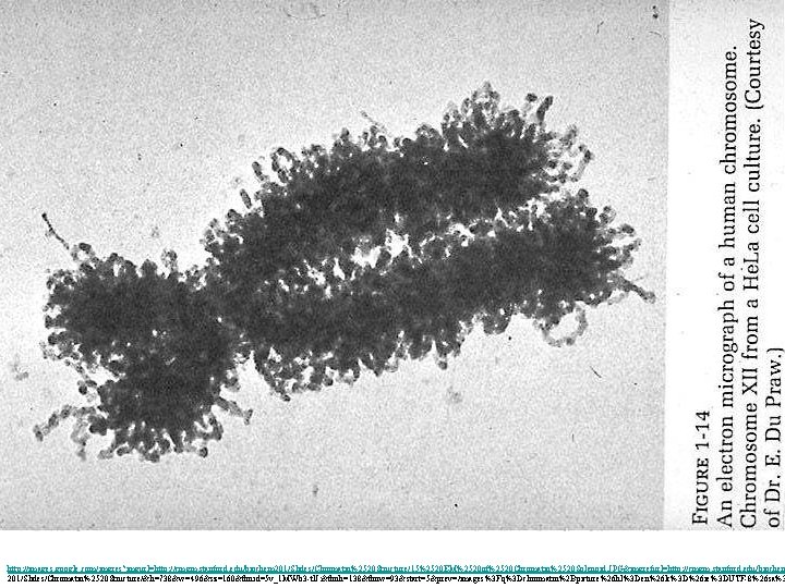 http: //images. google. com/imgres? imgurl=http: //cmgm. stanford. edu/biochem 201/Slides/Chromatin%2520 Structure/15%2520 EM%2520 of%2520 Chromatin%2520 Solenoid.