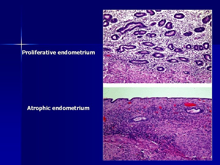 Proliferative endometrium Atrophic endometrium 