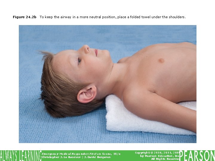 Figure 24. 2 b To keep the airway in a more neutral position, place
