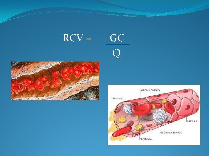  RCV = GC Q 