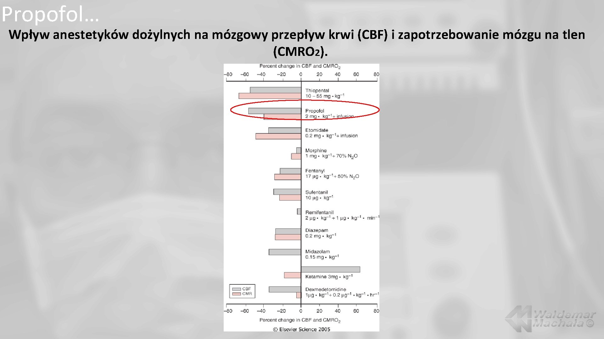 Propofol… Wpływ anestetyków dożylnych na mózgowy przepływ krwi (CBF) i zapotrzebowanie mózgu na tlen