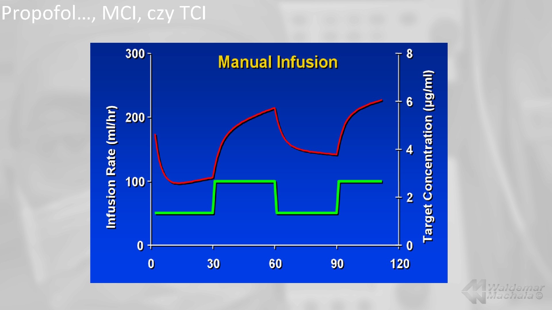 Propofol…, MCI, czy TCI 