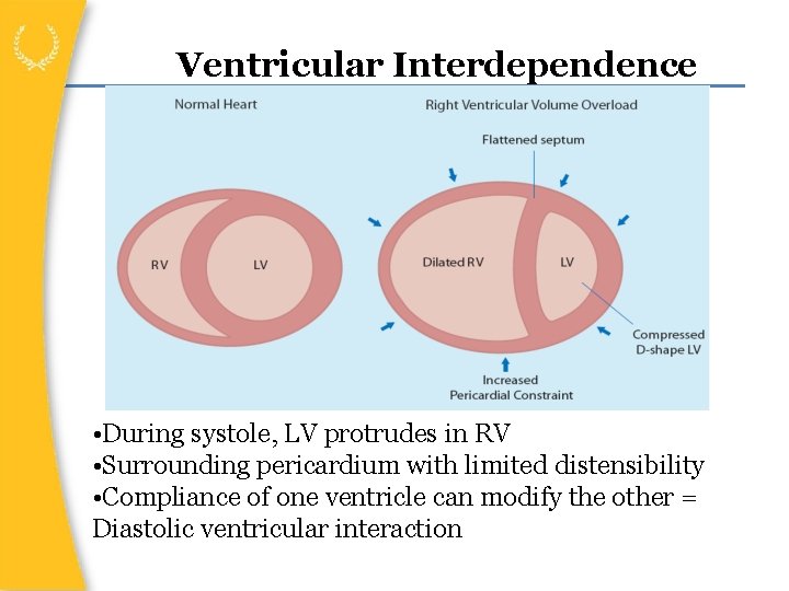 Ventricular Interdependence • During systole, LV protrudes in RV • Surrounding pericardium with limited