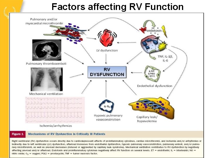Factors affecting RV Function 