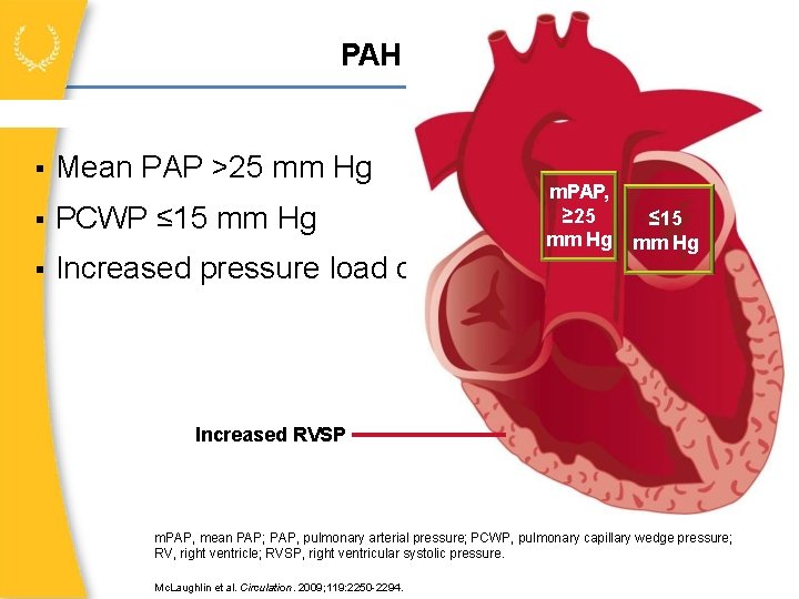 n RV PAH Definition Mean PAP >25 mm Hg PCWP ≤ 15 mm Hg
