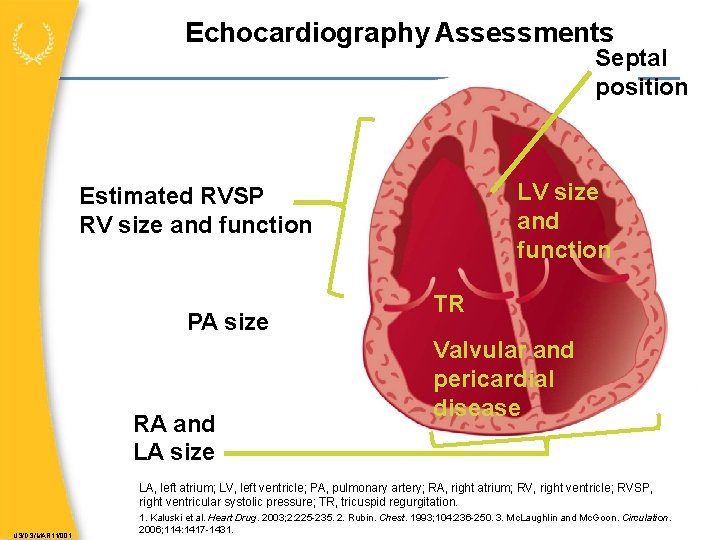 Echocardiography Assessments Septal position LV size and function Estimated RVSP RV size and function