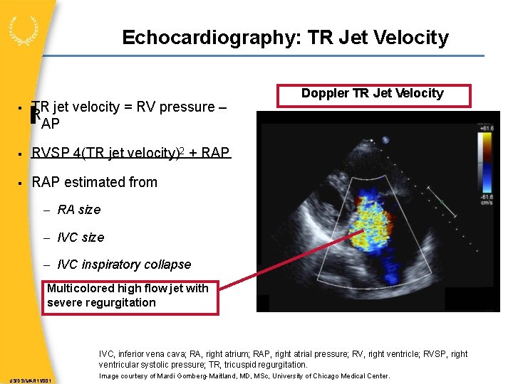 Echocardiography: TR Jet Velocity TR jet velocity = RV pressure – R AP RVSP