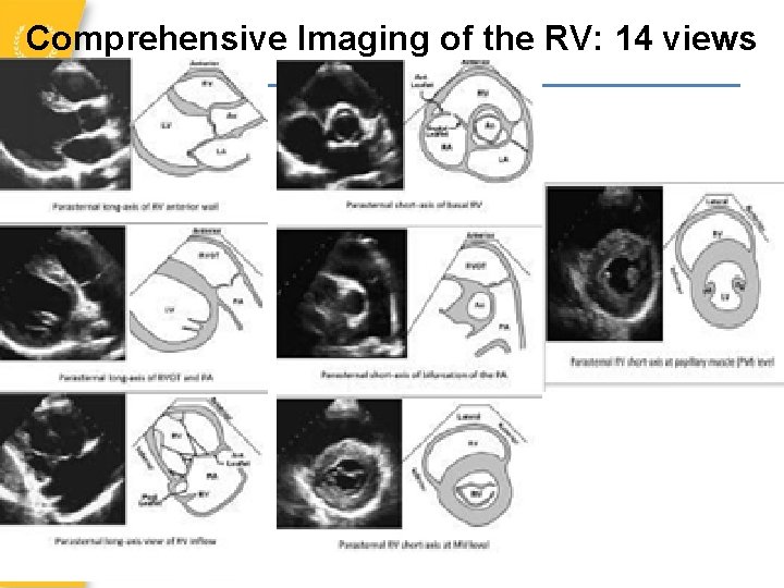 Comprehensive Imaging of the RV: 14 views 