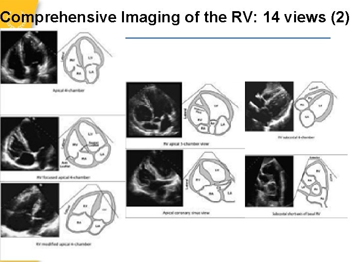 Comprehensive Imaging of the RV: 14 views (2) 