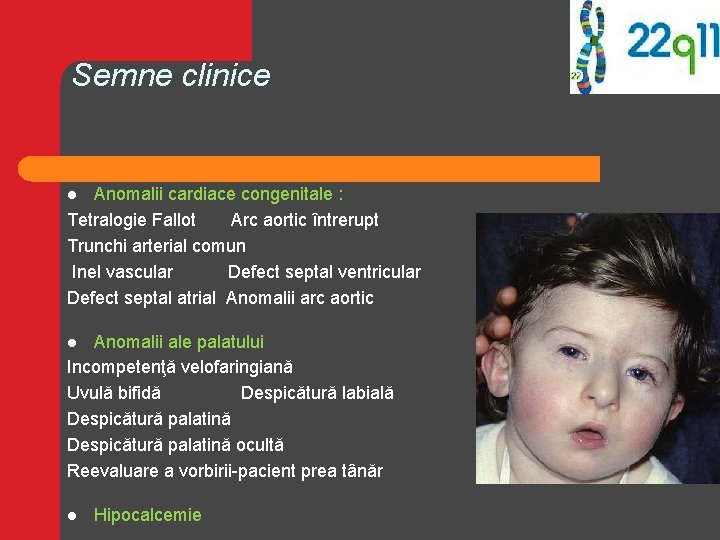 Semne clinice Anomalii cardiace congenitale : Tetralogie Fallot Arc aortic întrerupt Trunchi arterial comun Semne clinice Anomalii cardiace congenitale : Tetralogie Fallot Arc aortic întrerupt Trunchi arterial comun