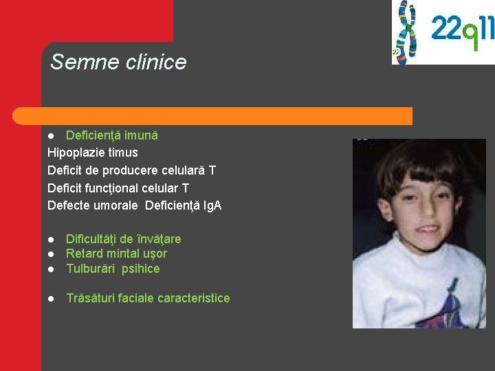 Semne clinice Deficienţă imună Hipoplazie timus Deficit de producere celulară T Deficit funcţional celular Semne clinice Deficienţă imună Hipoplazie timus Deficit de producere celulară T Deficit funcţional celular