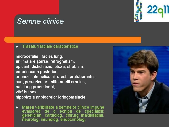 Semne clinice l Trăsături faciale caracteristice microcefalie, facies lung, arii malare şterse, retrognatism, epicant, Semne clinice l Trăsături faciale caracteristice microcefalie, facies lung, arii malare şterse, retrognatism, epicant,