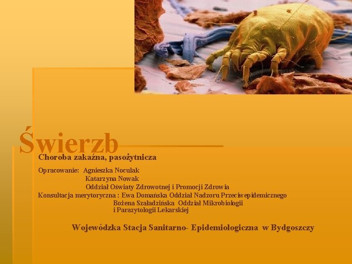Świerzb Choroba zakaźna, pasożytnicza Opracowanie: Agnieszka Noculak Katarzyna Nowak Oddział Oświaty Zdrowotnej i Promocji