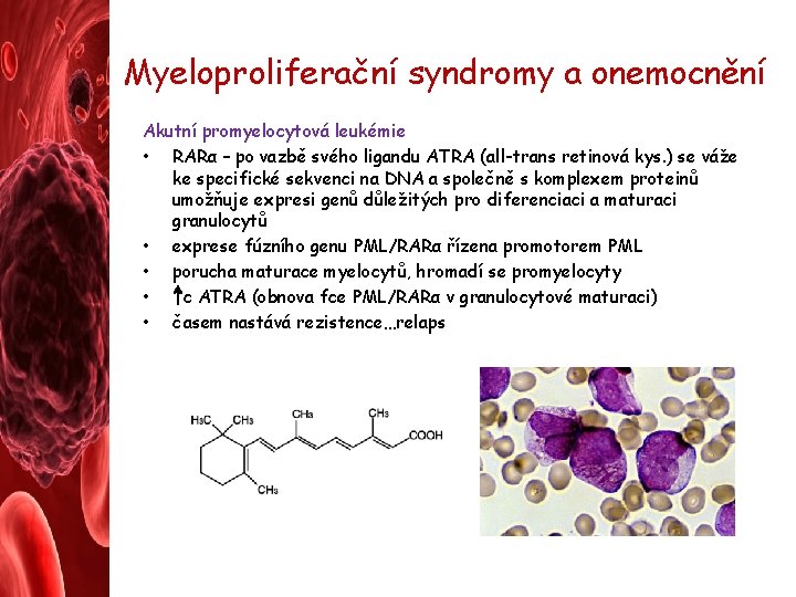 Myeloproliferační syndromy a onemocnění Akutní promyelocytová leukémie • RARα – po vazbě svého ligandu