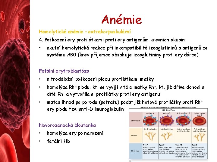 Anémie Hemolytické anémie - extrakorpuskulární 4. Poškození ery protilátkami proti ery antigenům krevních skupin