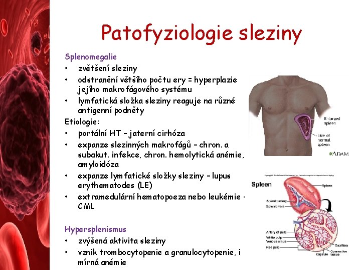 Patofyziologie sleziny Splenomegalie • zvětšení sleziny • odstranění většího počtu ery = hyperplazie jejího
