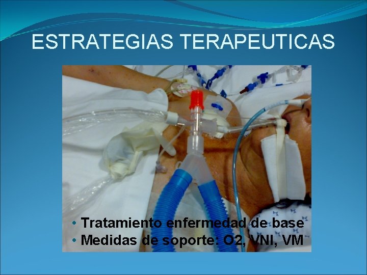 ESTRATEGIAS TERAPEUTICAS • Tratamiento enfermedad de base • Medidas de soporte: O 2, VNI,