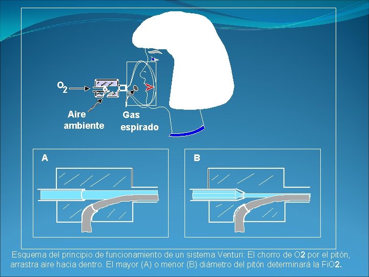 O 2 Aire ambiente A Gas espirado B Esquema del principio de funcionamiento de