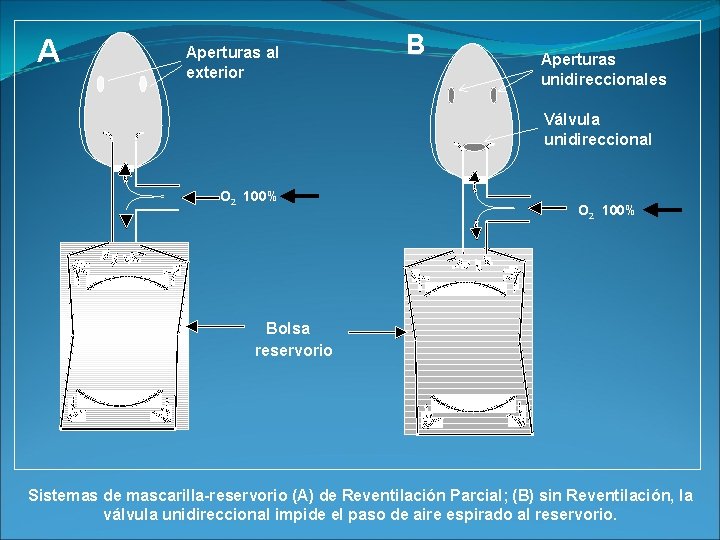 A Aperturas al exterior B Aperturas unidireccionales Válvula unidireccional O 2 100% Bolsa reservorio