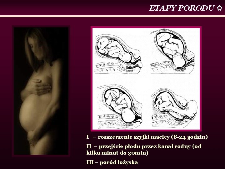 ETAPY PORODU I – rozszerzenie szyjki macicy (8 -24 godzin) II – przejście płodu
