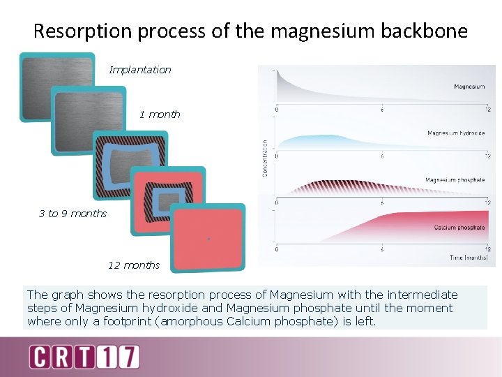 Resorption process of the magnesium backbone Implantation 1 month 3 to 9 months 12