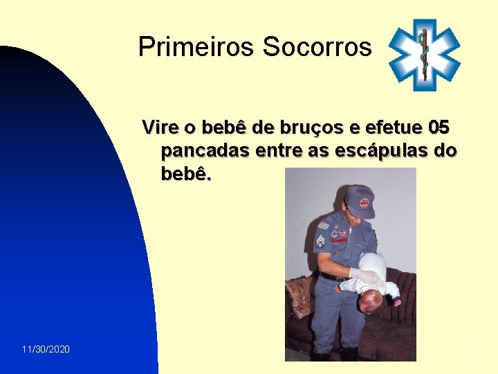 Primeiros Socorros Vire o bebê de bruços e efetue 05 pancadas entre as escápulas