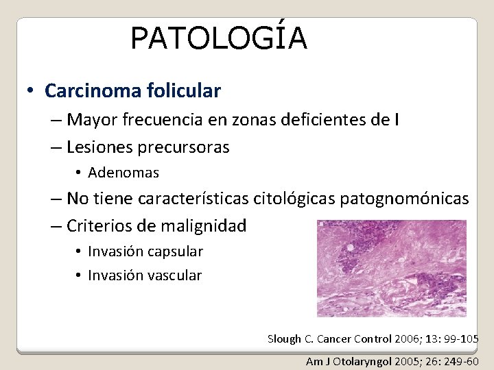 PATOLOGÍA • Carcinoma folicular – Mayor frecuencia en zonas deficientes de I – Lesiones