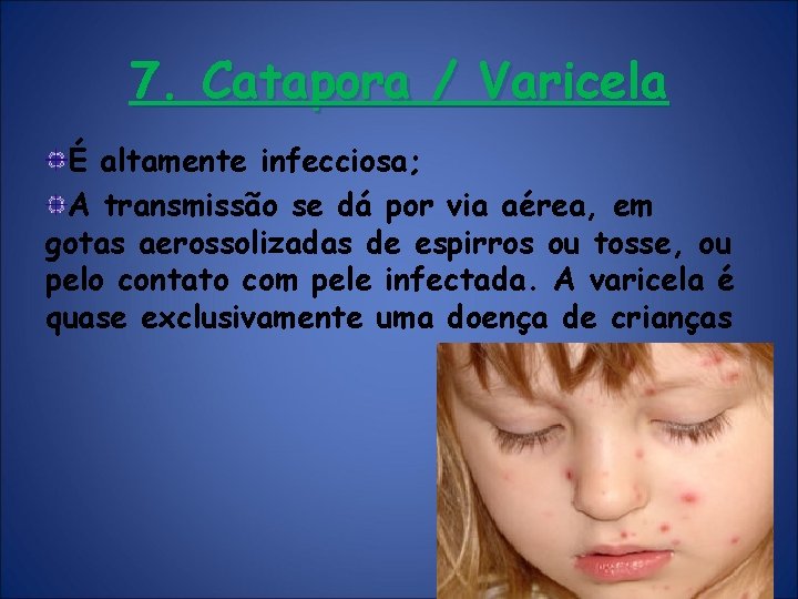 7. Catapora / Varicela É altamente infecciosa; A transmissão se dá por via aérea,