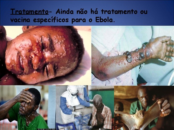 Tratamento- Ainda não há tratamento ou vacina específicos para o Ebola. Tratamento- Ainda não há tratamento ou vacina específicos para o Ebola.