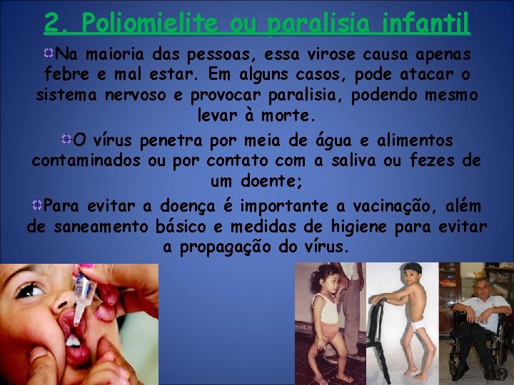 2. Poliomielite ou paralisia infantil Na maioria das pessoas, essa virose causa apenas febre