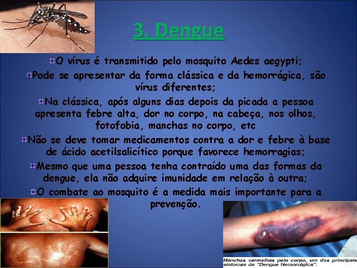 3. Dengue O vírus é transmitido pelo mosquito Aedes aegypti; Pode se apresentar da 3. Dengue O vírus é transmitido pelo mosquito Aedes aegypti; Pode se apresentar da