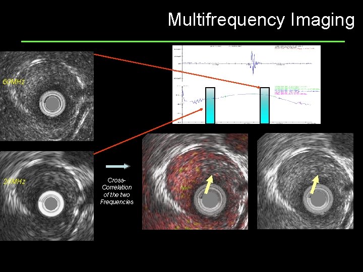 Multifrequency Imaging 60 MHz 20 MHz Cross. Correlation of the two Frequencies 