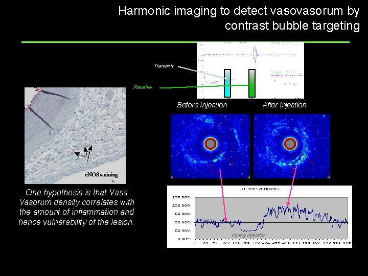 Harmonic imaging to detect vasorum by contrast bubble targeting Transmit Receive Before Injection After